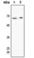 Anti-SHPTP1 Antibody